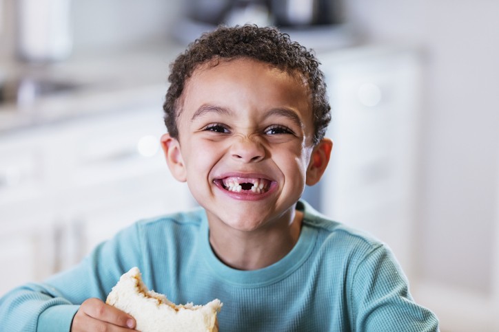 tooth extraction